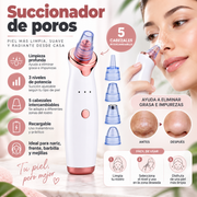 Succionador de poros